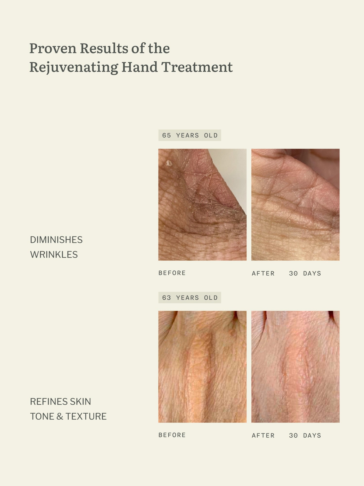 Rejuvenating Hand Treatment